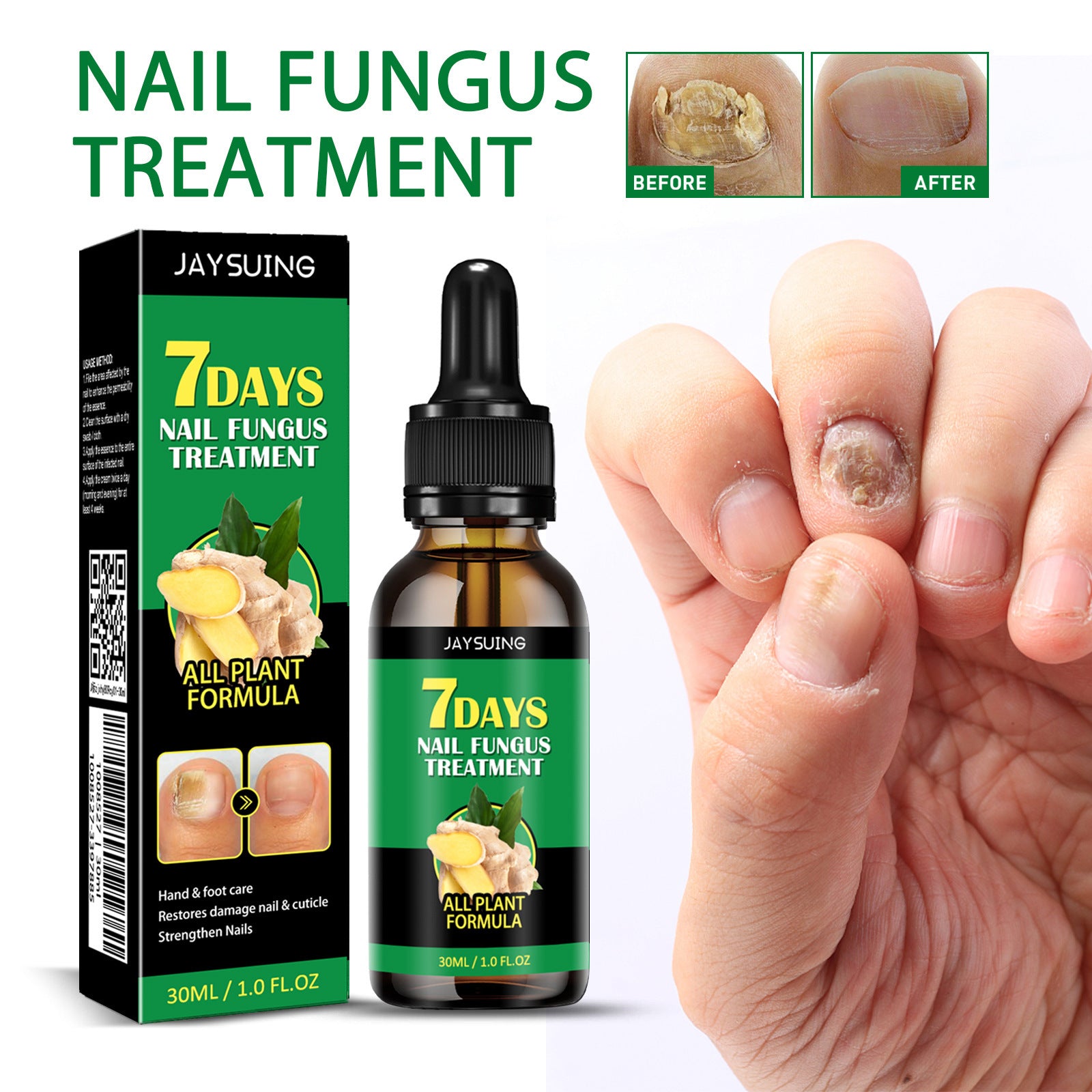 Ginger Nail Care Solution For Soft Nails